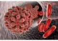 Mission Defeat Hepatitis Scales Up Nationwide Hepatitis B Screening