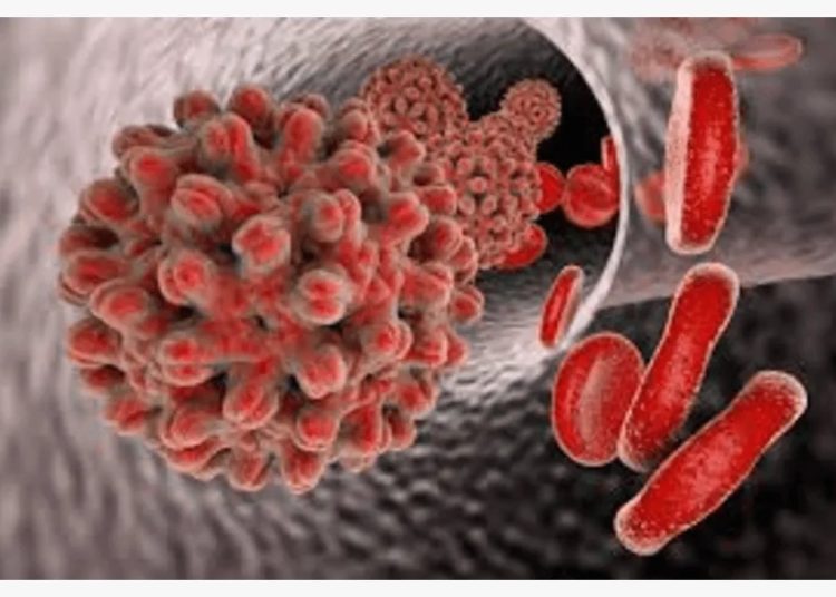 Mission Defeat Hepatitis Scales Up Nationwide Hepatitis B Screening